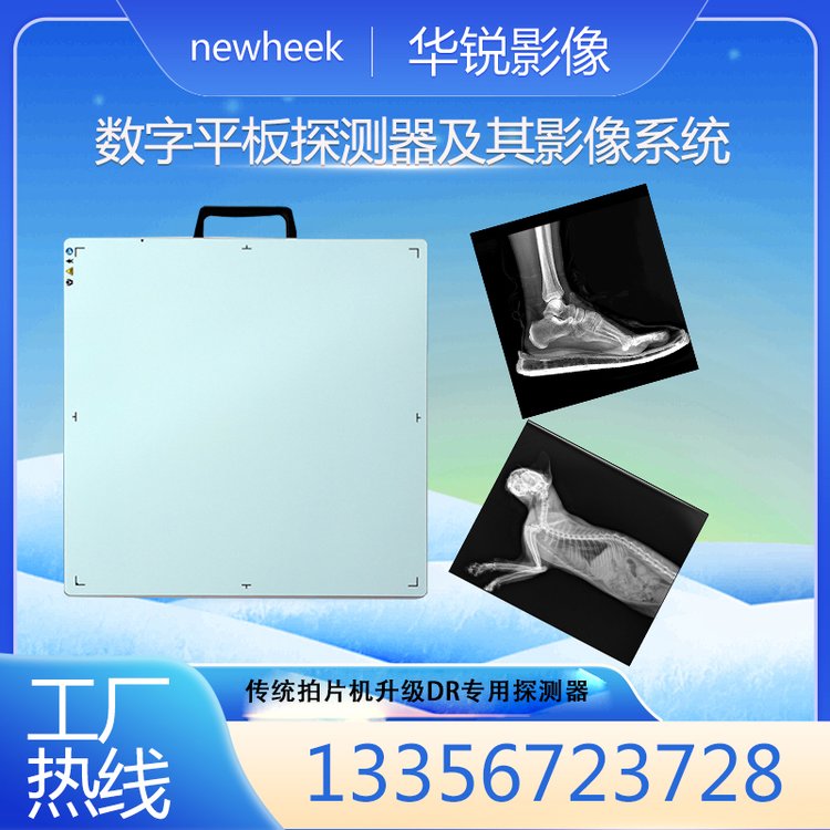 数字平板探测器及其影像系统拍片机升级医用dr检测成像板无线传输 黑色