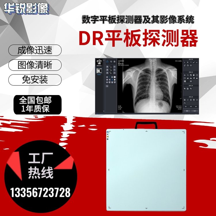 数字平板探测器及其影像系统拍片机升级医用dr检测成像板无线传输